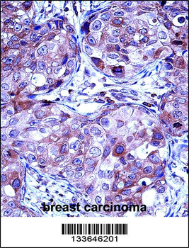 MMP13 Antibody (Center)