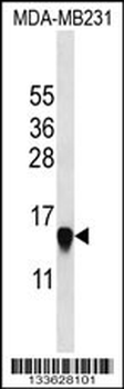 HIST2H2AA3 Antibody (N-term)