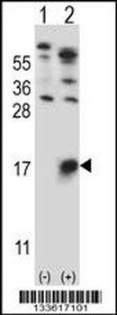 GYPB Antibody (Center)