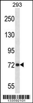 APP Antibody (Center)