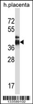 ITLN2 Antibody (Center)