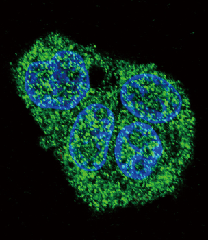 SFTPC Antibody (C-term)