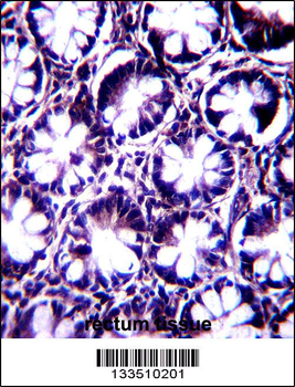 KIAA1274 Antibody (C-term)