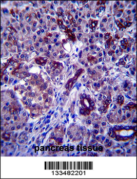 PPP1R3F Antibody (C-term)