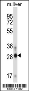 ATOH8 Antibody (N-term)