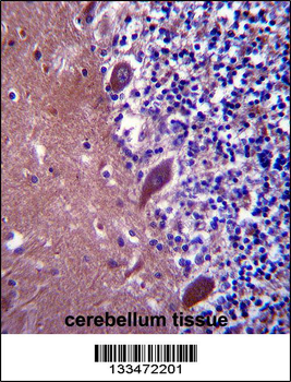 TTC13 Antibody (N-term)