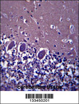 ABHD4 Antibody (Center)