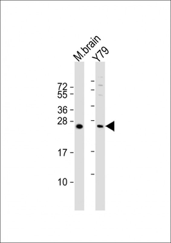 VKORC1L1 Antibody (N-term)