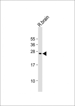 VKORC1L1 Antibody (N-term)