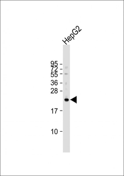VKORC1L1 Antibody (N-term)