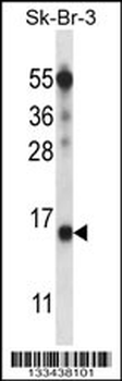 BTF3L4 Antibody (C-term)