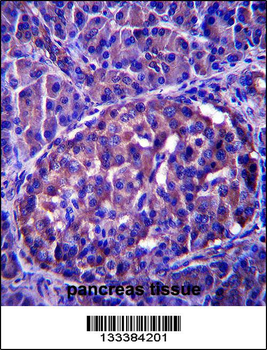 LRRN4 Antibody (C-term)