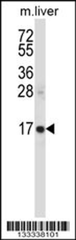 SSSCA1 Antibody (N-term )