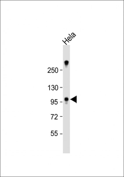 ZCCHC14 Antibody (Center)