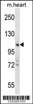 ZCCHC14 Antibody (Center)
