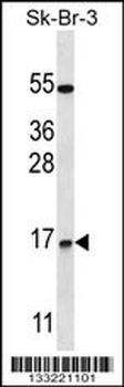 NRARP Antibody (Center)