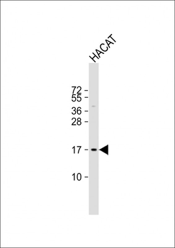 NRARP Antibody (Center)