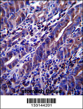 MUC1/EMA Antibody (C-term)