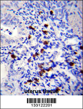 TNN Antibody (Center)