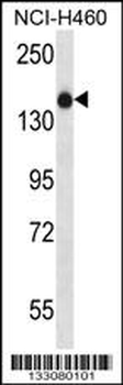 XIRP1 Antibody (C-term)