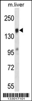 TIAM2 Antibody (N-term)