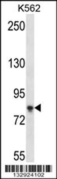 SAMD4B Antibody (C-term)