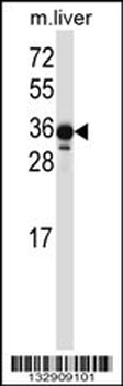 LIMS2 Antibody (C-term)