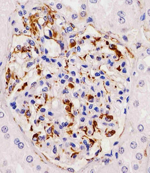 RHBDF2 Antibody (N-term)