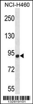 CHSY1 Antibody (Center)