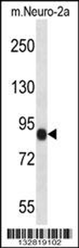 CHSY1 Antibody (Center)