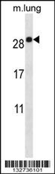 EMP2 Antibody (C-term)