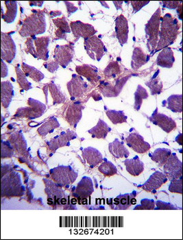 HSPA12B Antibody (N-term)