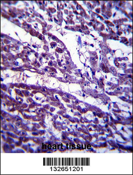 TUBGCP5 Antibody (N-term)