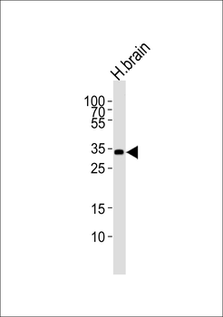 STMN4 Antibody (N-term)