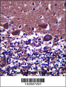 DNAL4 Antibody (N-term)