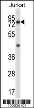 MCOLN1 Antibody (C-term)