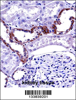 MCOLN1 Antibody (C-term)