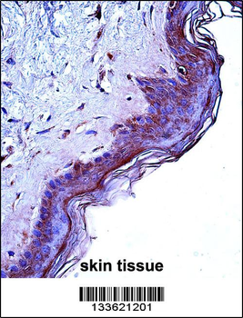 CD1A Antibody (Center)