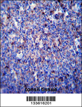 MMP3 Antibody (N-term)