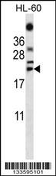 TNF Antibody (C-term)