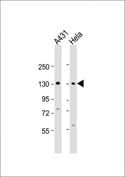 ZBTB11 Antibody (C-term)