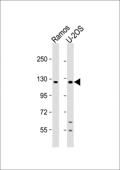 UBN2 Antibody (N-term)