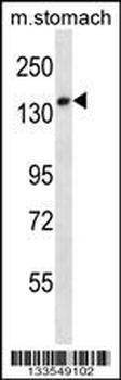 UBN2 Antibody (N-term)