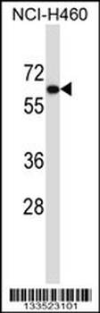 UGT2B11 Antibody (C-term)