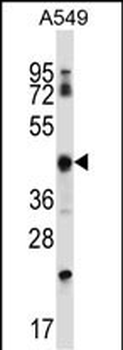 KRT37 Antibody (Center)