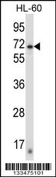 ZNF415 Antibody (N-term)