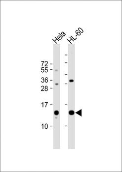PHF5A Antibody (C-term)