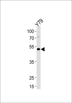 FOXN4 Antibody (N-term)