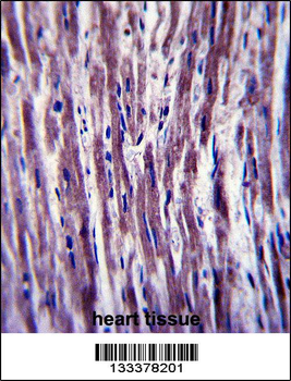 PTPLA Antibody (N-term)