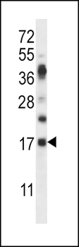 RNASE6 Antibody (C-term)